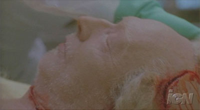 Saw IV - Autopsy